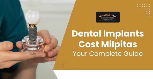 Dental Implants Cost Milpitas - Silicon Valley Dentistry