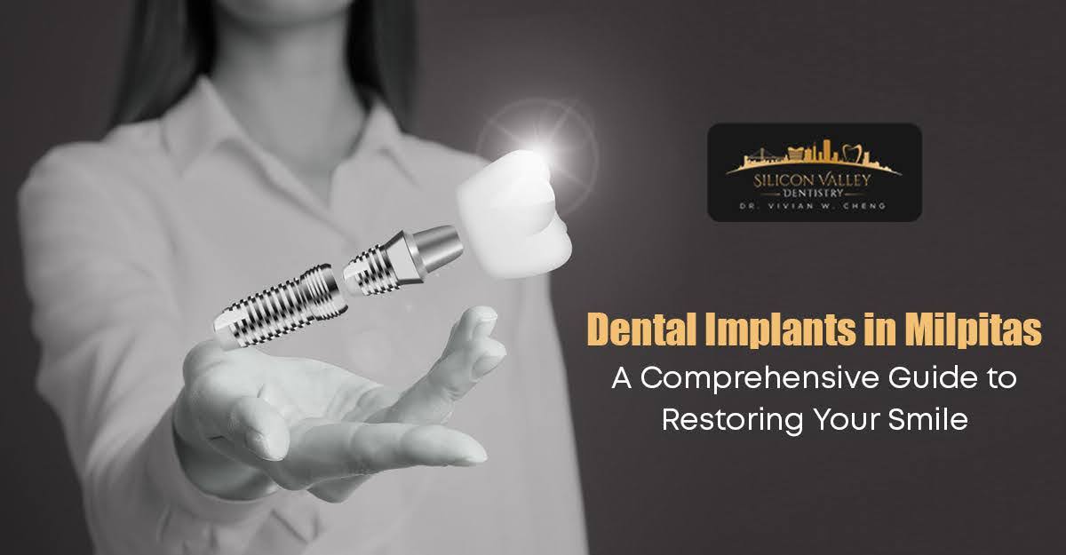 Dental Implants in Milpitas: A Comprehensive Guide to Restoring Your Smile